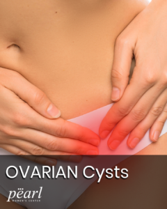 Can Ovarian Cysts Cause Lower Back Pain?